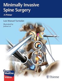 Minimally invasive spine surgery