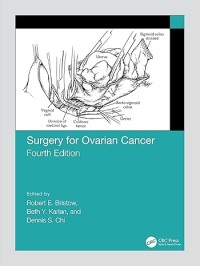 Surgery for ovarium cancer